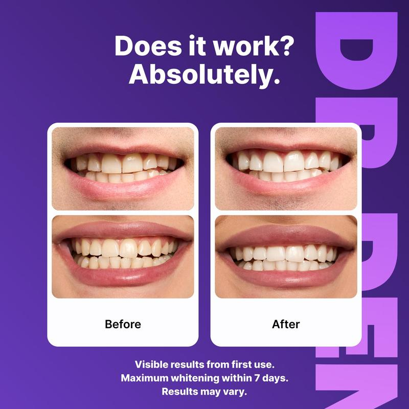 VELORA Purple Teeth Whitening Strips - 7/21 Whitening Sessions - Safe for Enamel - Non Sensitive Teeth Whitening - Peroxide-Free-JAY