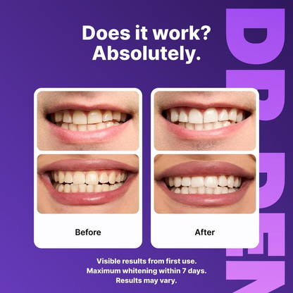VELORA Purple Teeth Whitening Strips - 7/21 Whitening Sessions - Safe for Enamel - Non Sensitive Teeth Whitening - Peroxide-Free-JAY
